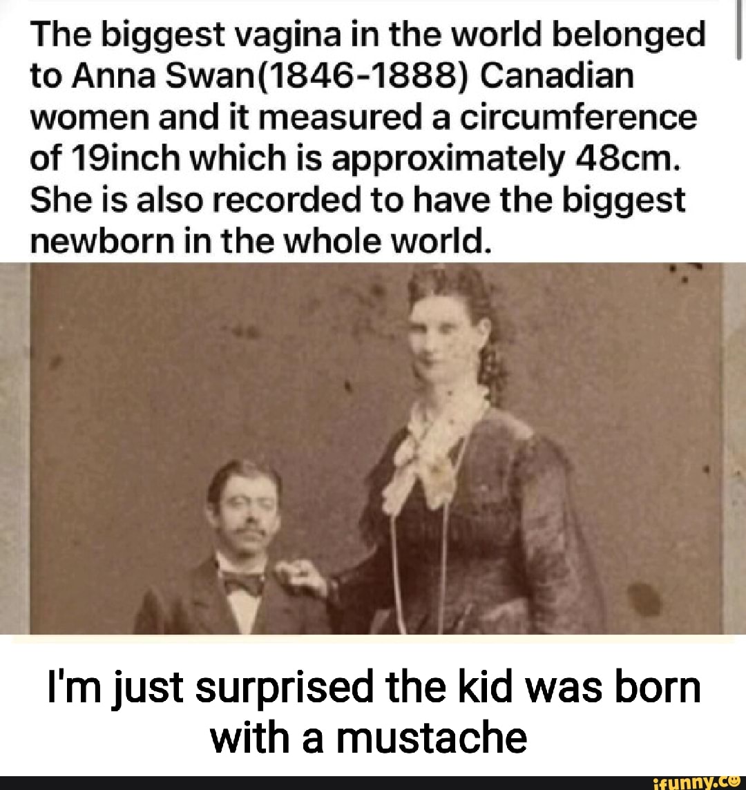 The Biggest Vagina In The World Belonged To Anna Canadian Women And It