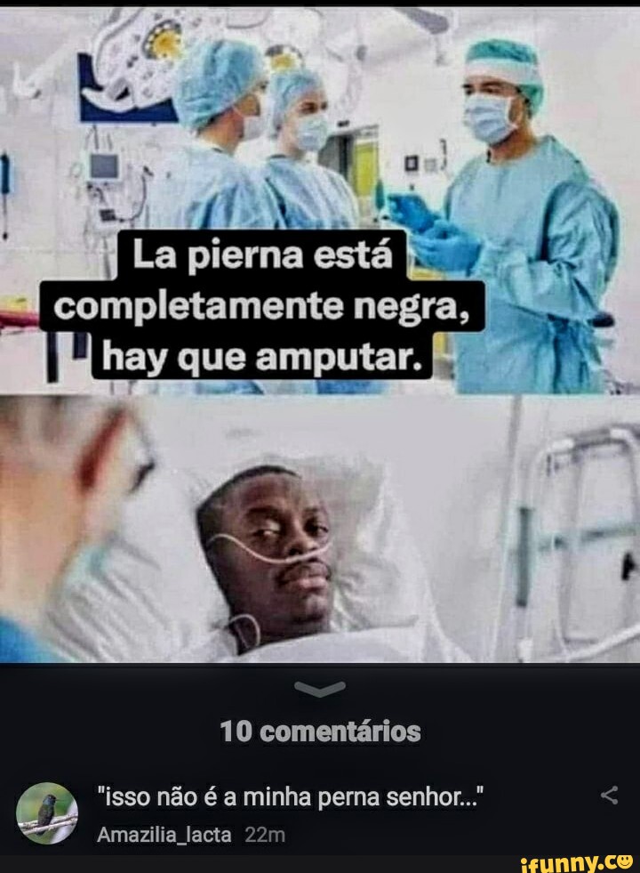 La Pierna Est I Completamente Negra Hay Que Amputar I Coment Rios