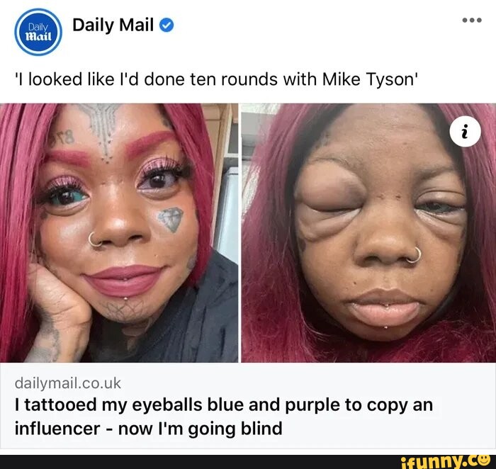 Daily Mail Looked Like I D Done Ten Rounds With Mike Tyson Gally Uk I