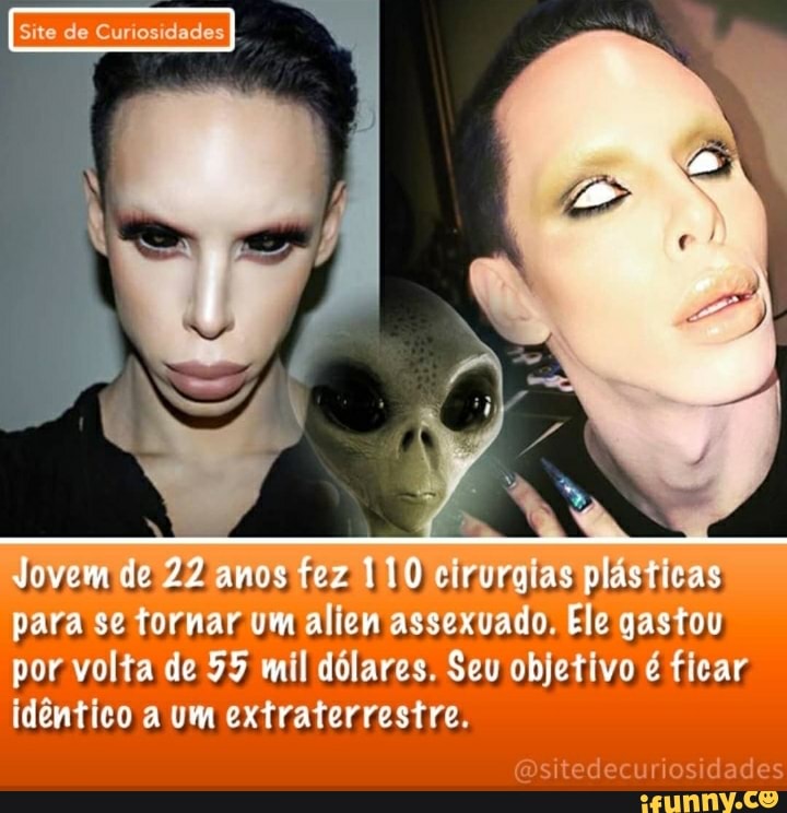 Site de Curnesidades I.
Jovem de 22 amos fez 110 cirurgias plásticas para se tornar um aliem assexuado. Ele gastou por volta de 55 mil dólares. Seu objetivo é ficar idêntico a um extraterrestre.
(Ositedecuriosidades