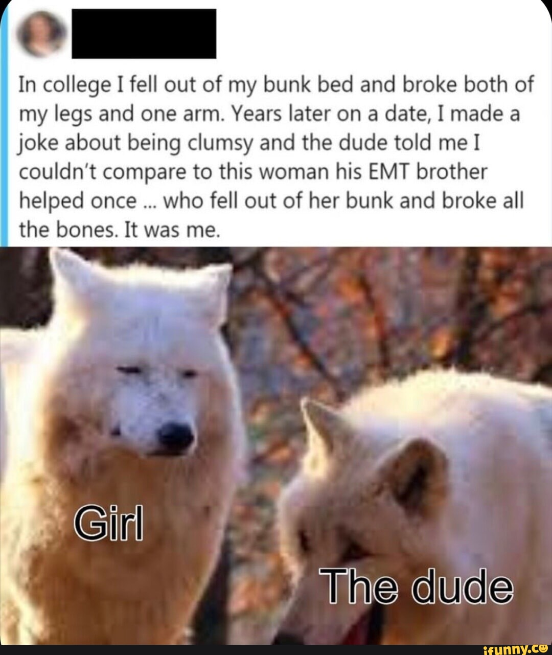 In college I fell out of my bunk bed and broke both of my legs and one