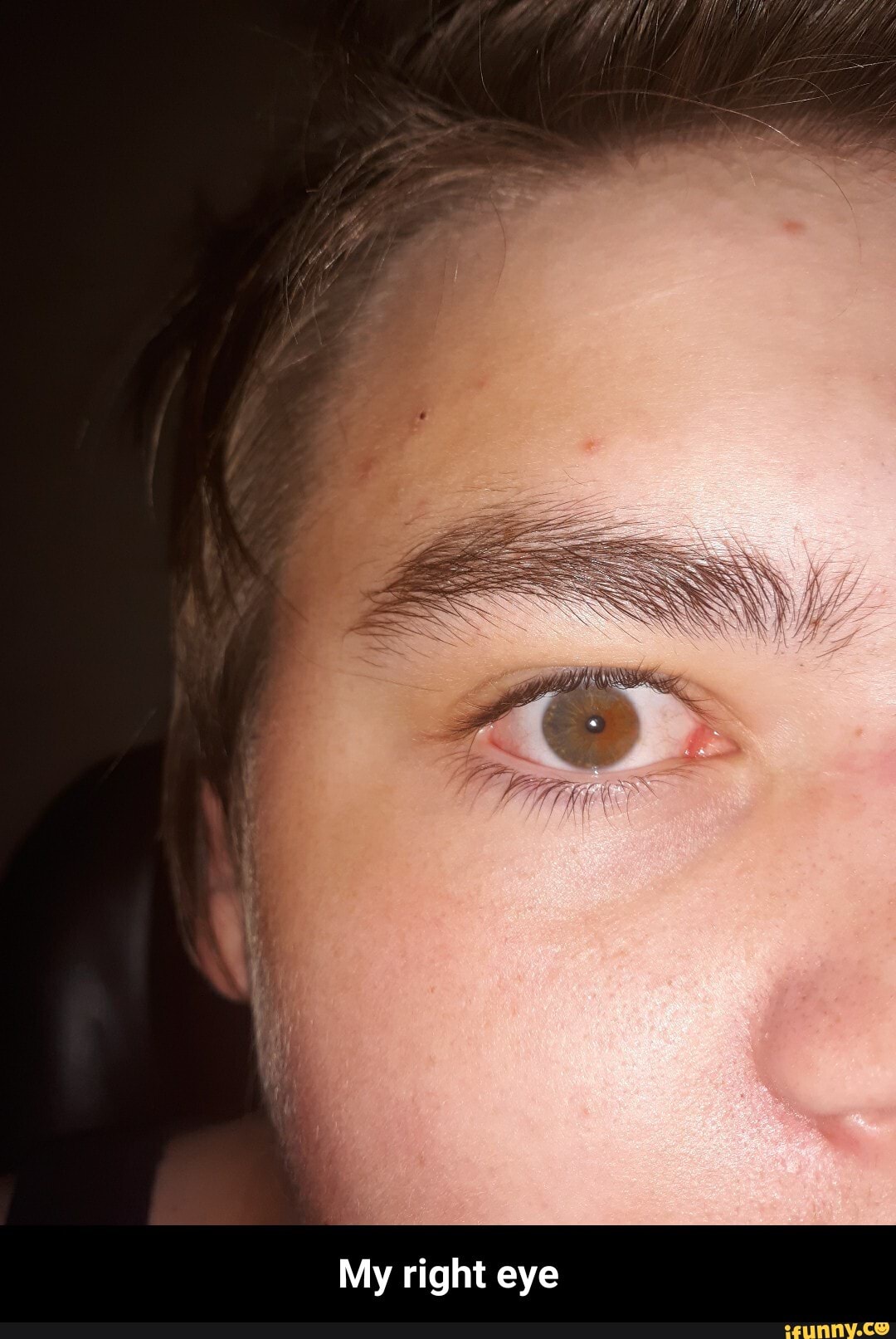 My right eye - My right eye