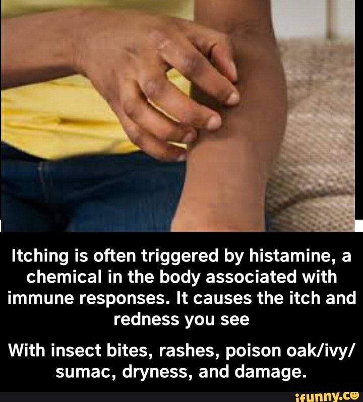 Itching is often triggered by histamine, a chemical in the body associated with immune responses. It causes the itch and redness you see
With insect bites, rashes, poison sumac, dryness, and damage. - With insect bites, rashes, poison oak/ivy/sumac, dryness, and damage.