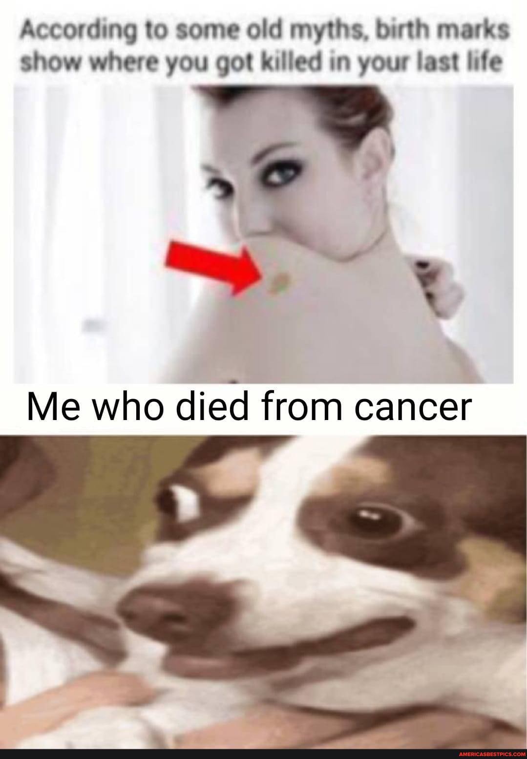 According to some old myths, birth marks show where you got killed in your last life
Me who died from cancer