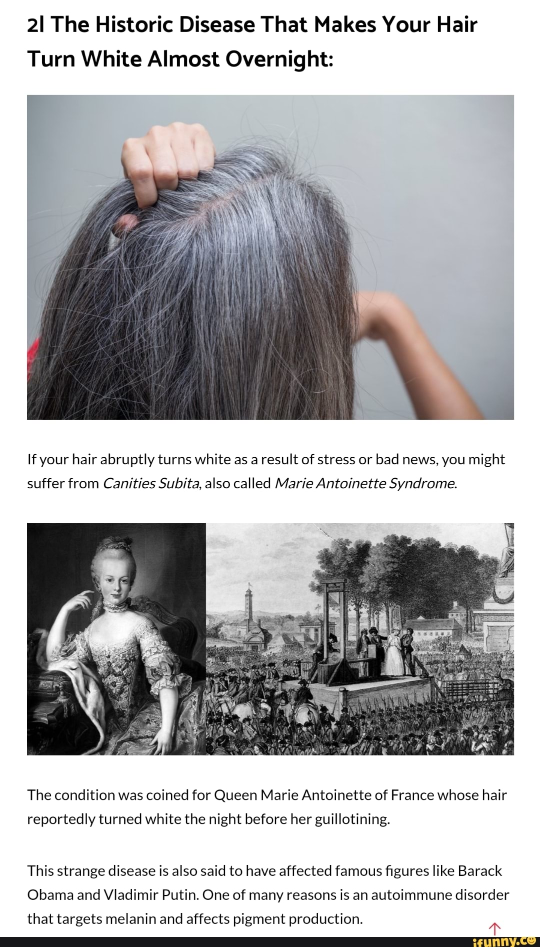 21 The Historic Disease That Makes Your Hair Turn White Almost Overnight:  If your hair abruptly
