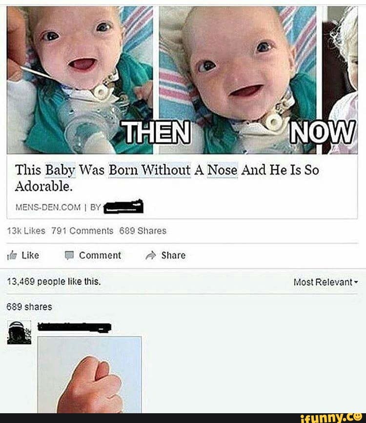 people born without noses