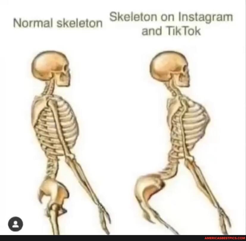 Skeleton on tiktok - Skeleton on Instagram and TikTok Normal skeleton ...