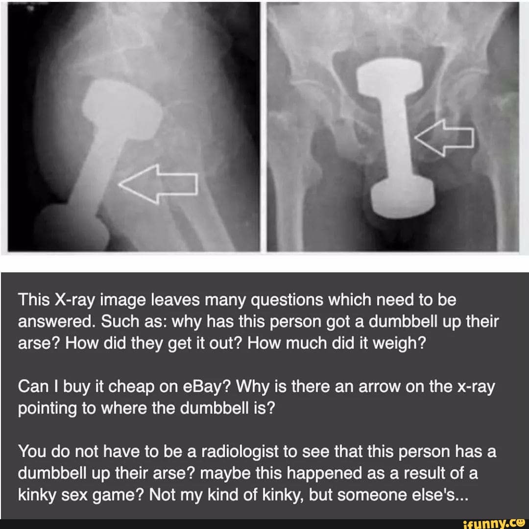 This X-ray image leaves many questions which need to be answered. Such as:  why has