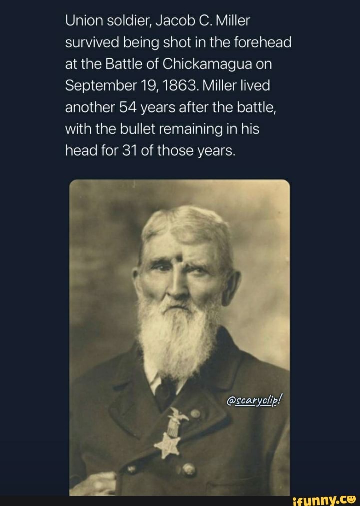 Union soldier, Jacob C. Miller survived being shot in the forehead at
