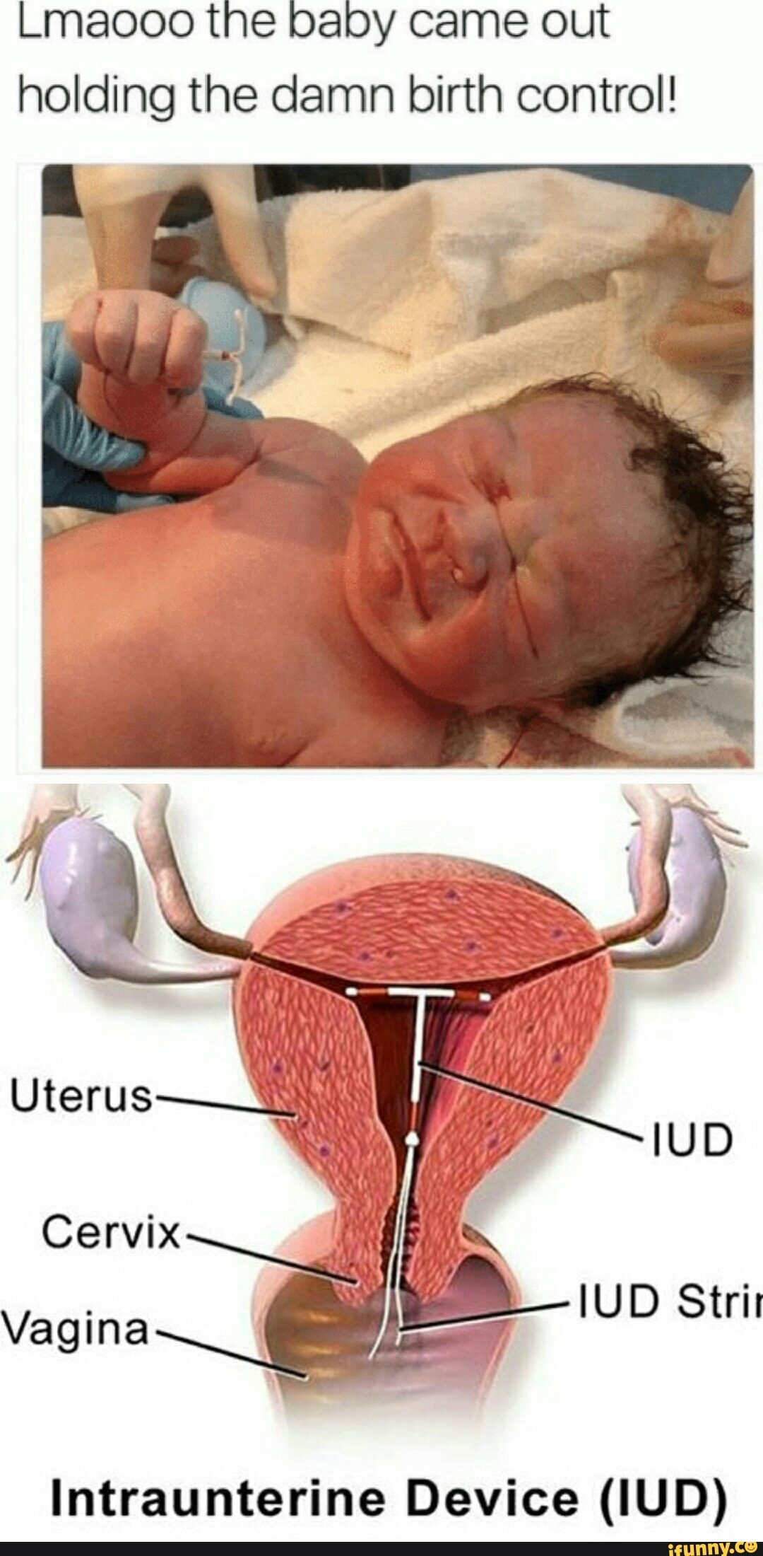 baby born holding iud