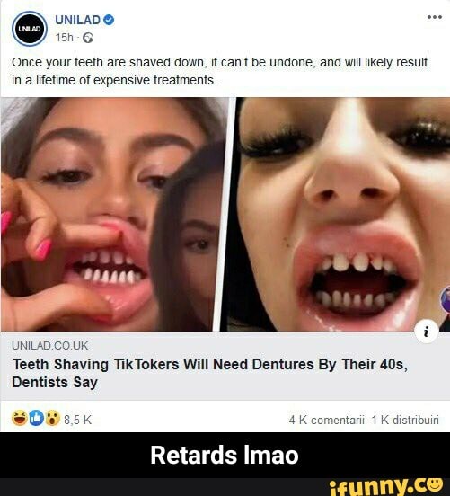 Once your teeth are shaved down, it can't be undone, and will likely