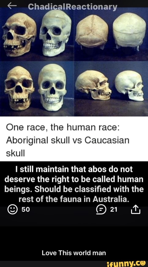 One Race The Human Race Aboriginal Skull Vs Caucasian Skull I Still Maintain That Abos Do