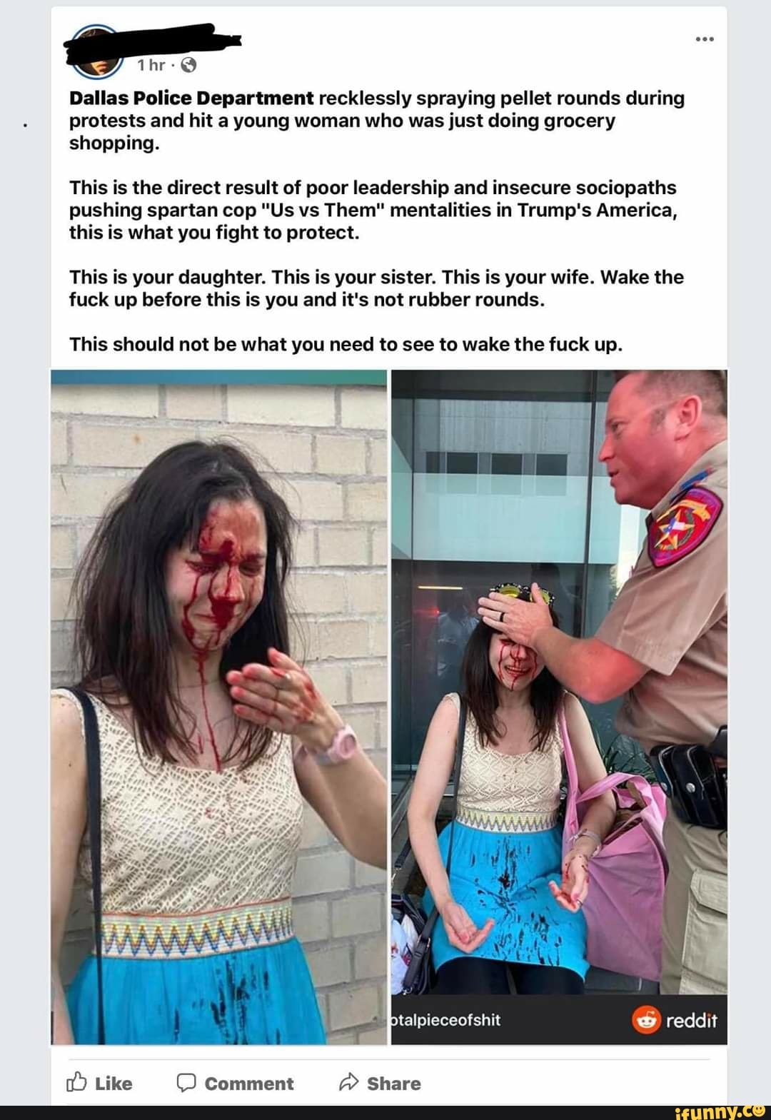 Dallas Police Department recklessly spraying pellet rounds during
protests and hit a young woman who was just doing grocery
shopping.
This is the direct result of poor leadership and insecure sociopaths
pushing spartan cop "Us vs Them" mentalities in Trump's America,
this is what you fight to protect.
This is your daughter. This is your sister. This is your wife. Wake the
fuck up before this is you and it's not rubber rounds.
This should not be what you need to see to wake the fuck up.
