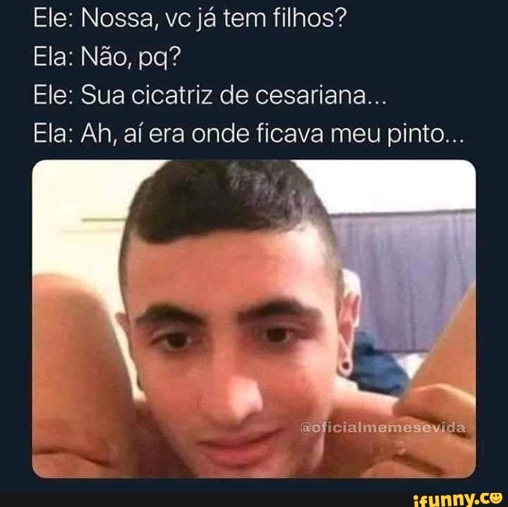 Ele: Nossa, vc já tem filhos?
Ele: Sua cicatriz de cesariana...
Ela: Ah, ai era onde ficava meu pinto...