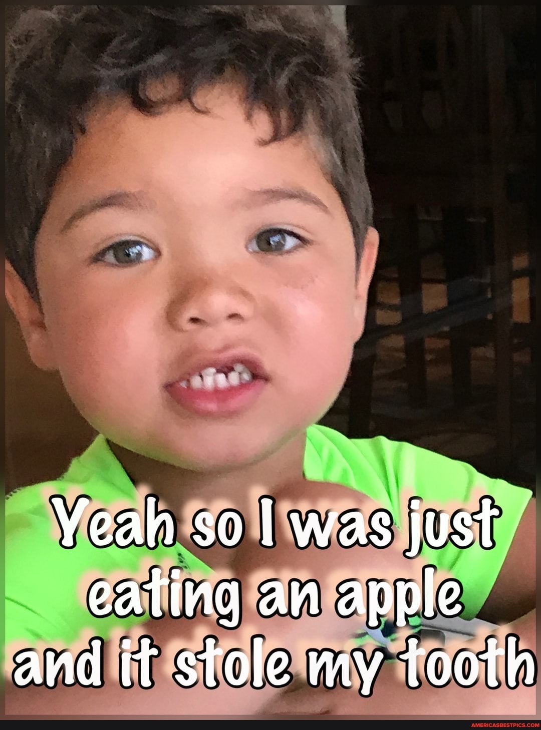 Yeah so I was just eating an apple and it stole my tooth