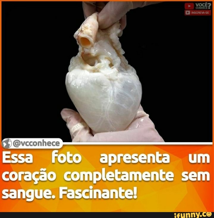 VOCÊ?
Essa foto apresenta um coração completamente sem sangue. Fascinante!