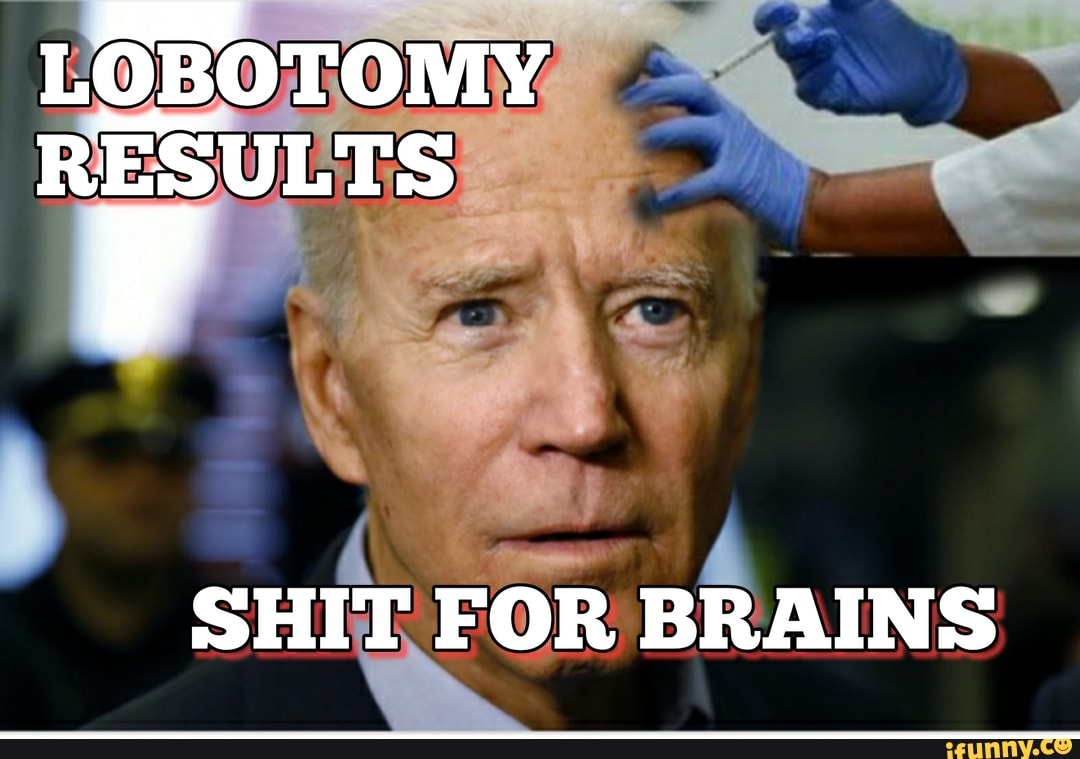 LOBOTOMY RESULTS
SHIT FOR BRAINS
