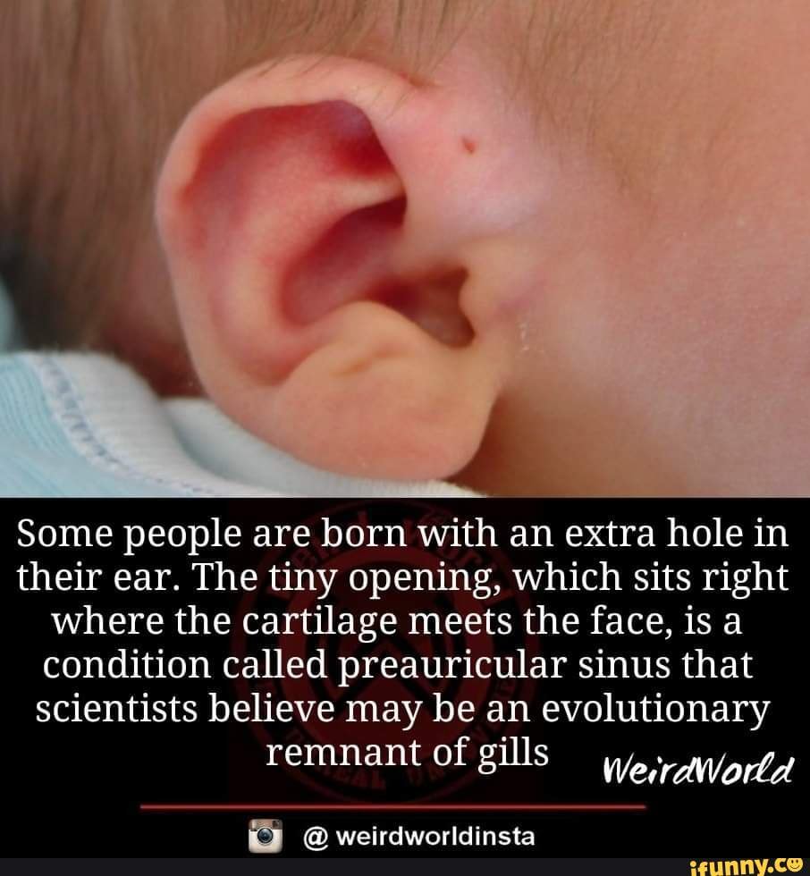 people born with gills