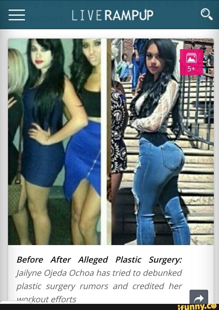 == LIVERAMPUP a Before After Alleged Plastic Surgery Jailyne Ojeda(01)