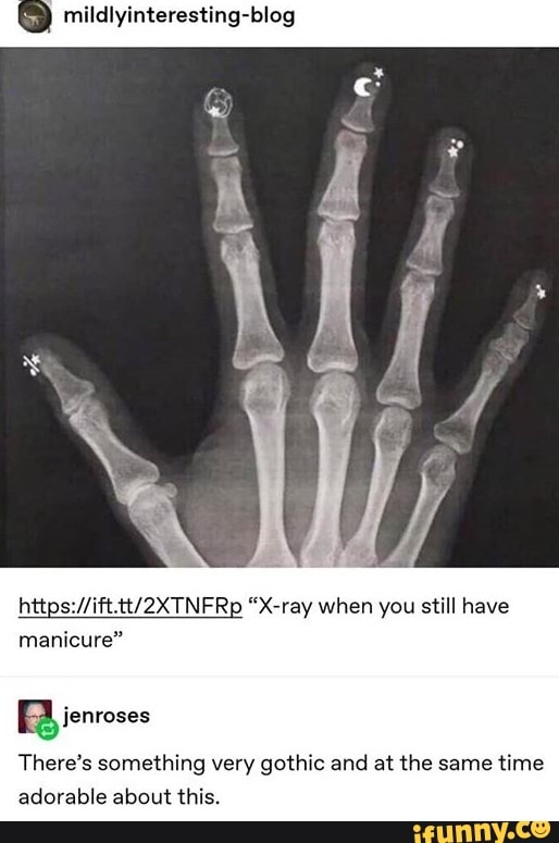 https://ift.tt/2XTNFRp "X-ray when you still have
manicure"
There's something very gothic and at the same
time
adorable about this.