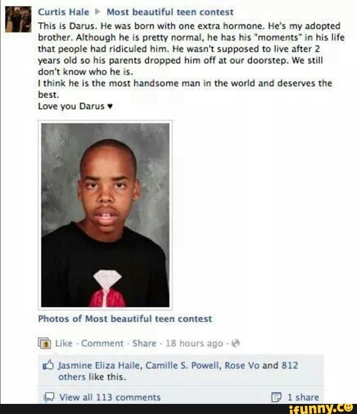 Curtis Hale Most beautiful teen contest This is Darus. He was born with