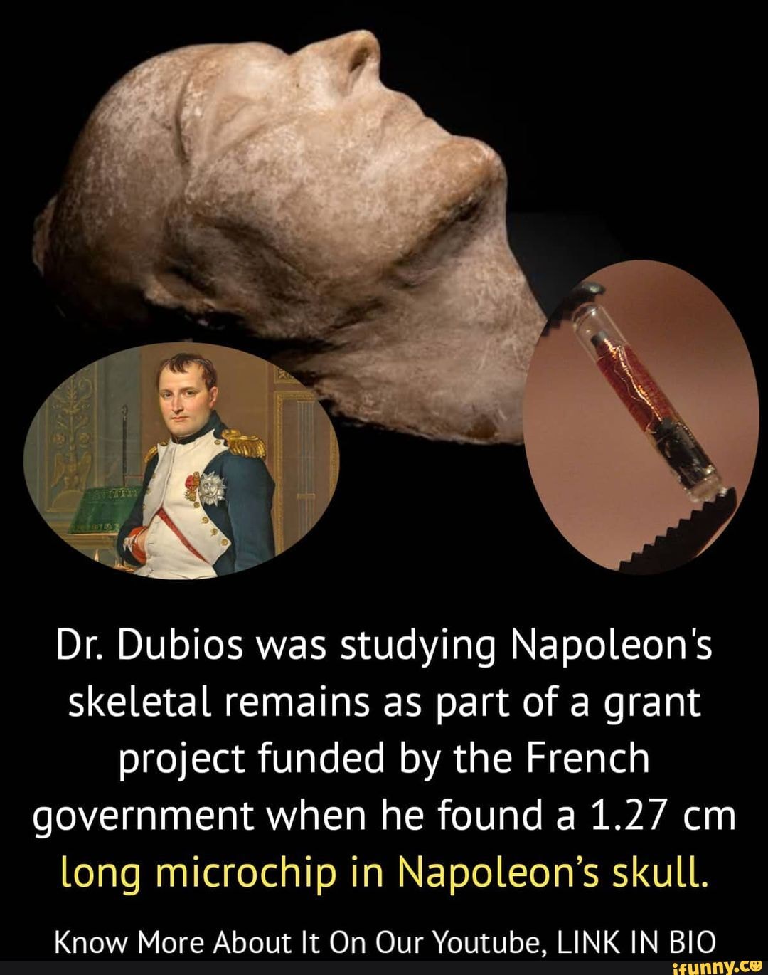 Dr. Dubios was studying Napoleon's skeletal remains as part of a grant  project funded by the