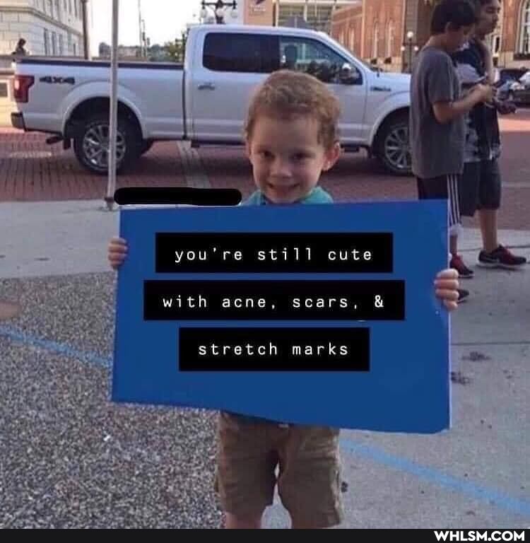 you're still cute
with acne, scars, &
stretch marks
