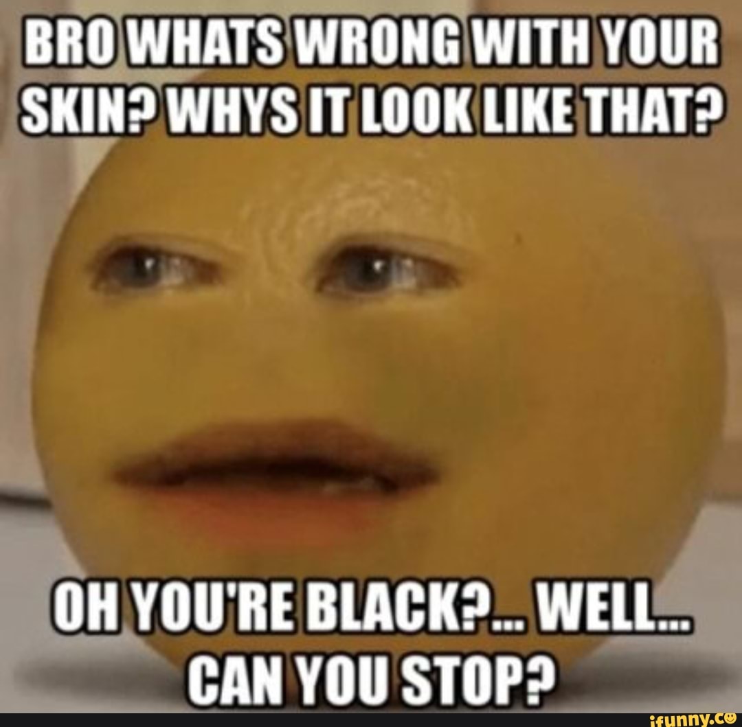 BROIWHATS WRONG WITH YOUR
SKIN? WHYS IT LOOK LIKE THAT?
CAN YOU STOP?