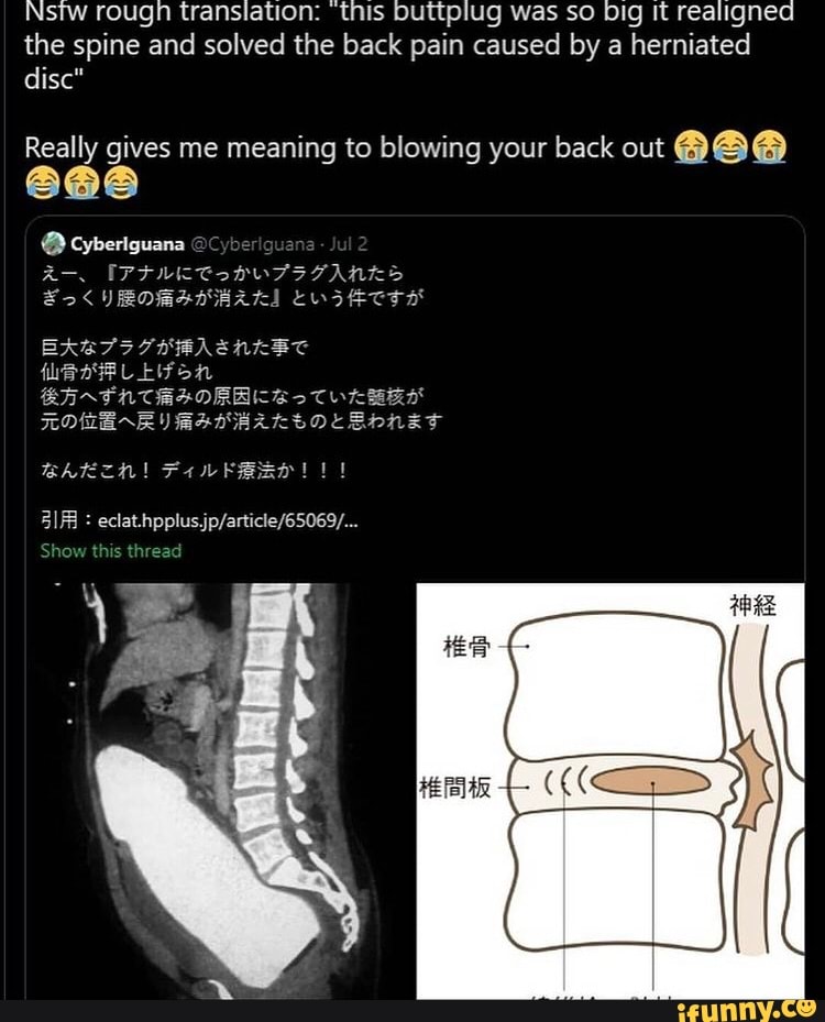 Nstw Rough Translation This Buttplug Was So Big It Realigned The Spine And Solved The Back