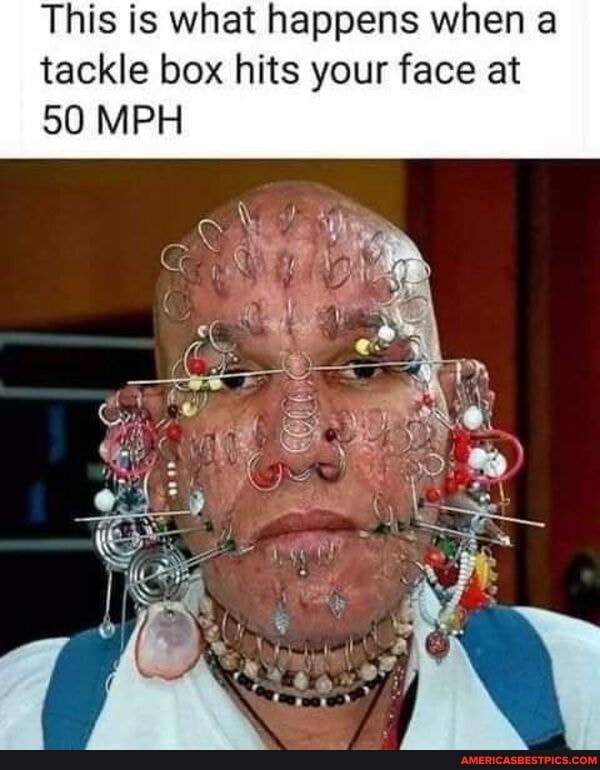 This is what happens when a tackle box hits your face at
50