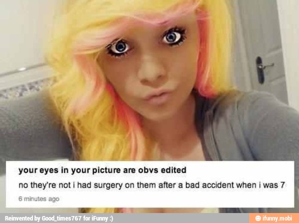 I
your eyes in your picture are obvs edited
no they're not I had surgery on them after a bad accident when I was 7
