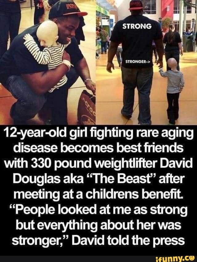 12-year-old girl fighting rare aging
disease becomes best friends
with 330 pound weightlifter David
Douglas aka "The Beast' after
meeting at a childrens benefit.
"People looked at me as strong
but everything about her was
stronger," David told the press