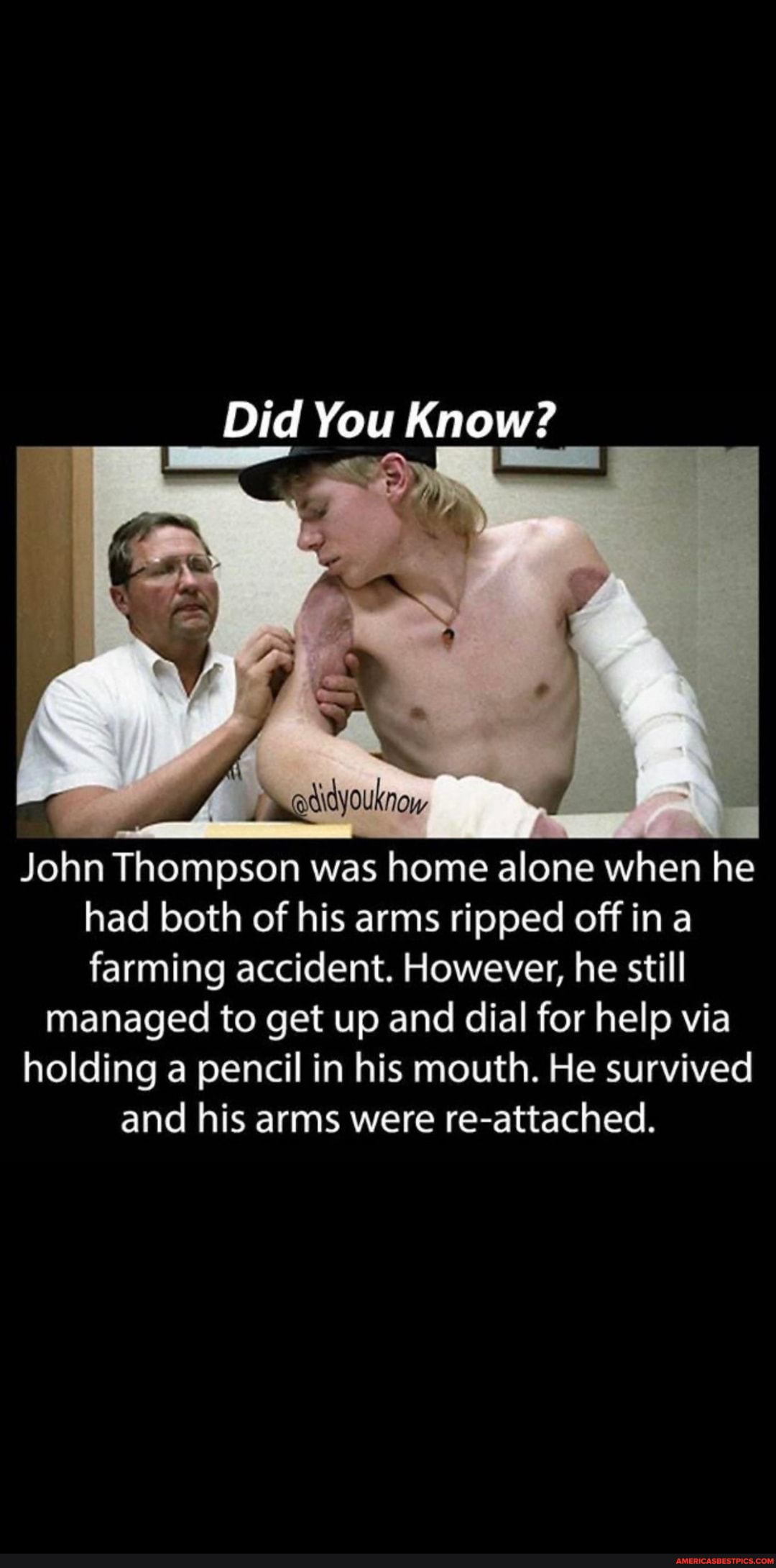 Did You Know?
John Thompson was home alone when he had both of his arms ripped off in a farming accident. However, he still
managed to get up and dial for help via holding a pencil in his mouth. He survived and his arms were re-attached.