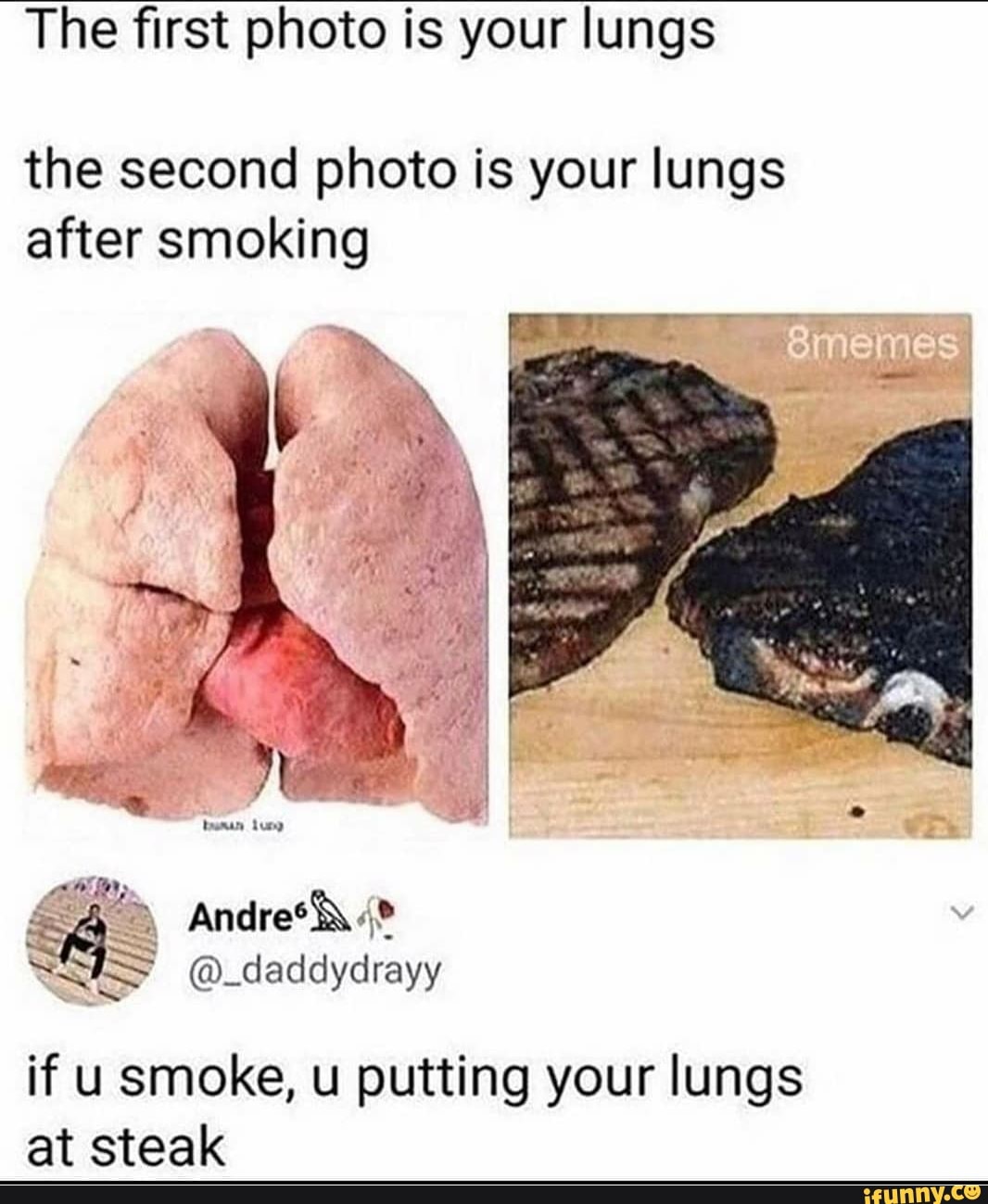 The first photo is your lungs
the second photo is your lungs
after smoking
SIS
@_daddydrayy
if u smoke, u putting your lungs
at steak