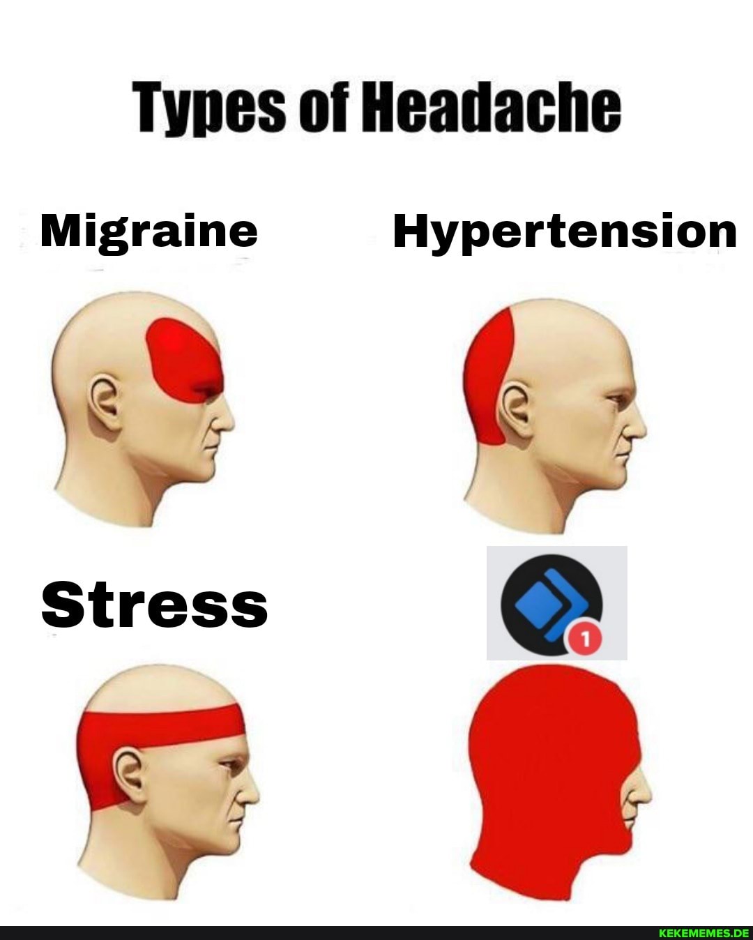 Types Of Heatache Migraine Hypertension Stress - Englisch