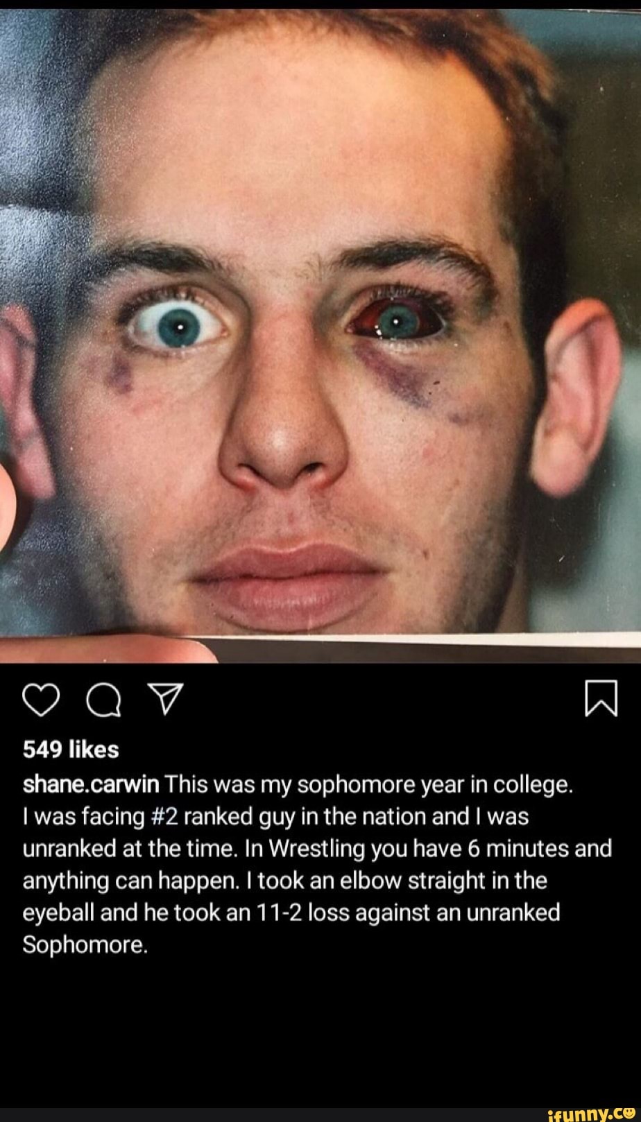 549 likes
shane.carwin This was my sophomore year in college.
I was facing #2 ranked guy in the nation and I was
unranked at the time. In Wrestling you have 6 minutes and
anything can happen. I took an elbow straight in the
eyeball and he took an 11-2 loss against an unranked
Sophomore.