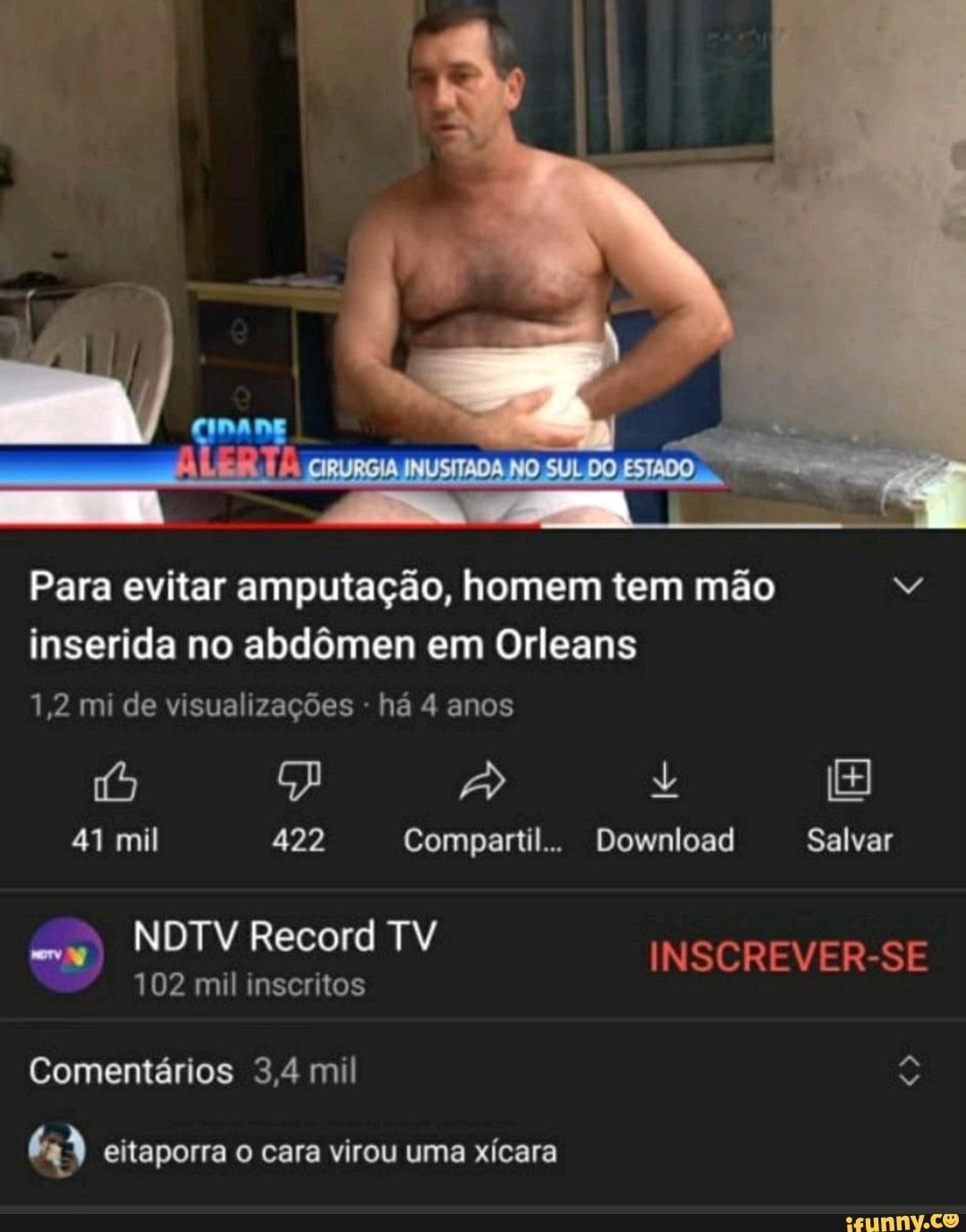 NO SUL DO Para evitar amputação, homem tem mão
inserida no abdômen em Orleans
1,2 mi de visualizações - há 4 anos
41 mil 422 Compartil.. Download Salvar
NDTV Record TV INSCREVER-SE
102 mil inscritos
Comentários 3,4 mil
eitaporra o cara virou uma xícara