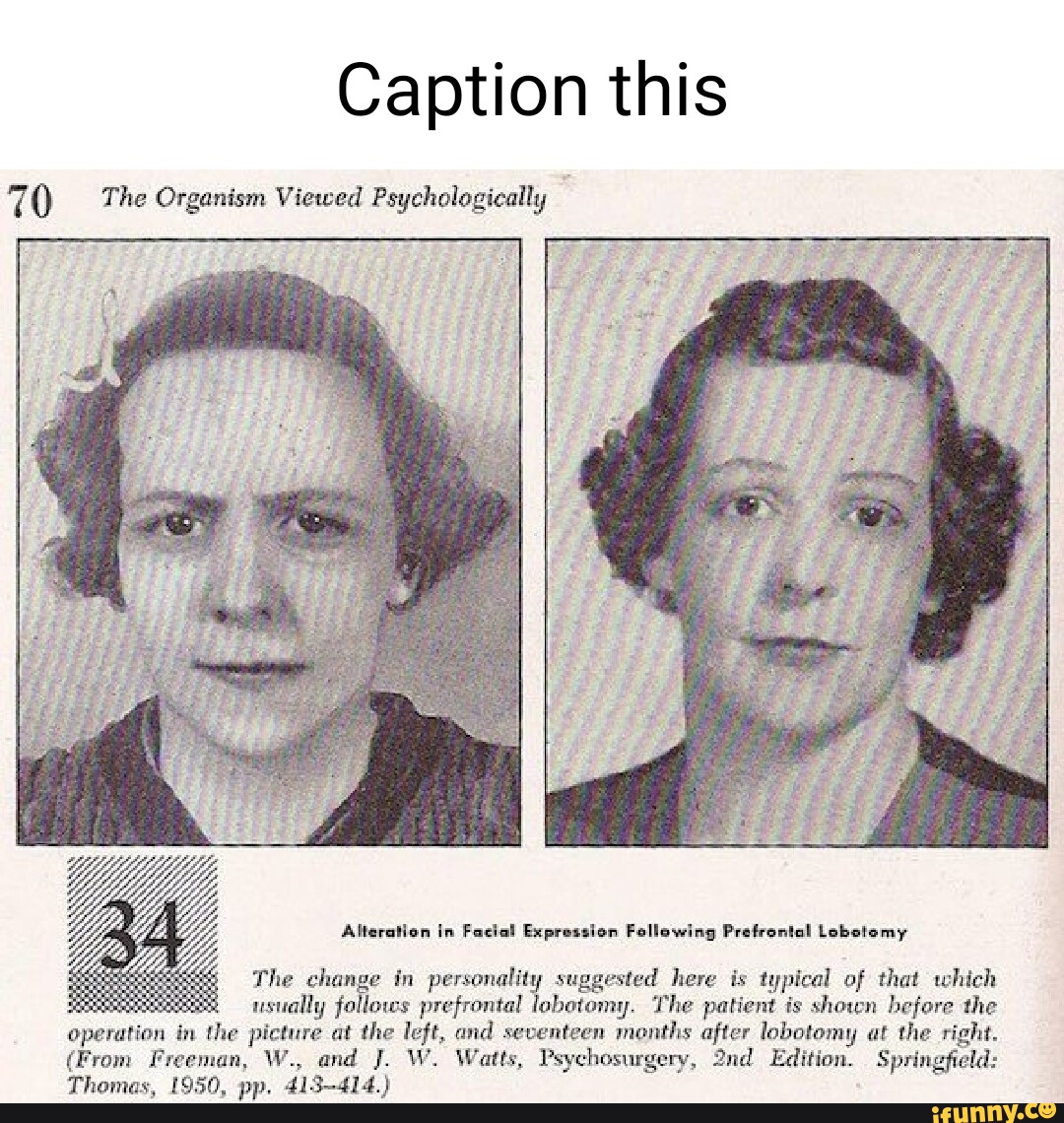 Caption this The Organism Viewed Psychologically Alteration in Facial ...