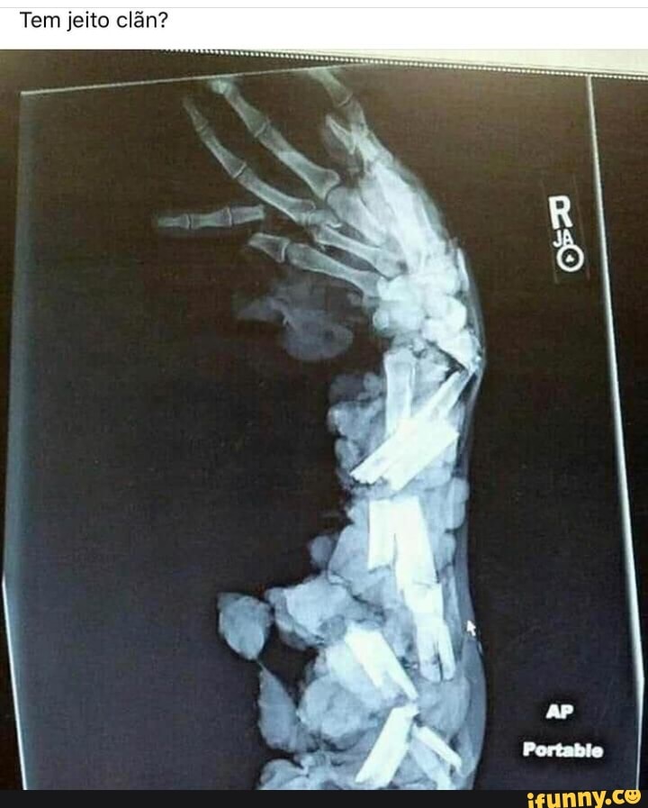 elén?
Tem jeito clãn?