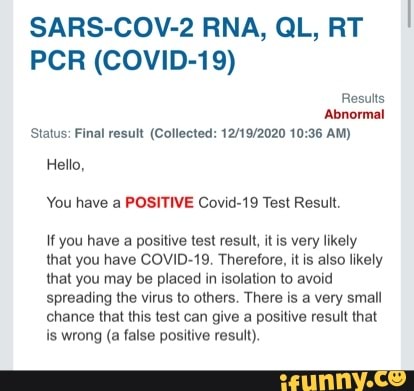 sars cov 2 rna ql rt pcr covid 19 positive