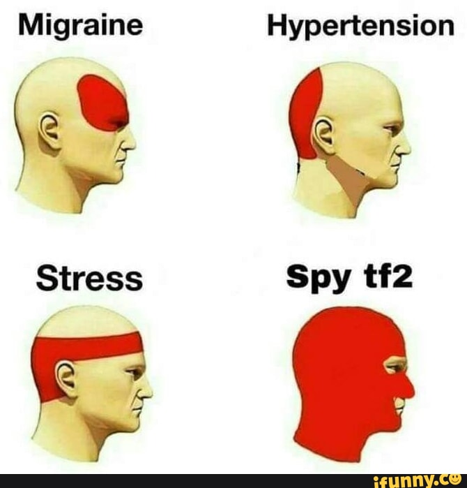 Did this tree job for an old lady for 1000. Didn't feel right charging