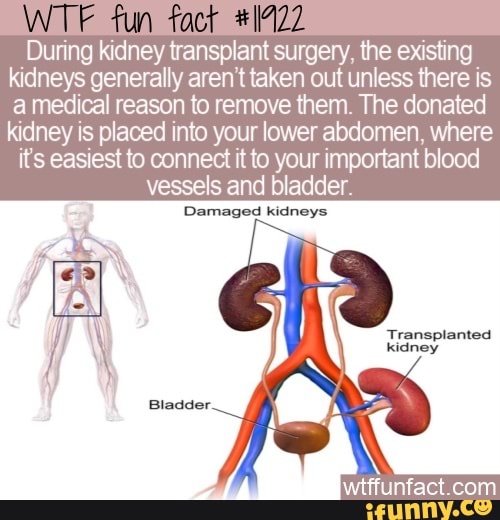 Fun During kidney transplant surgery, the existing kidneys generally