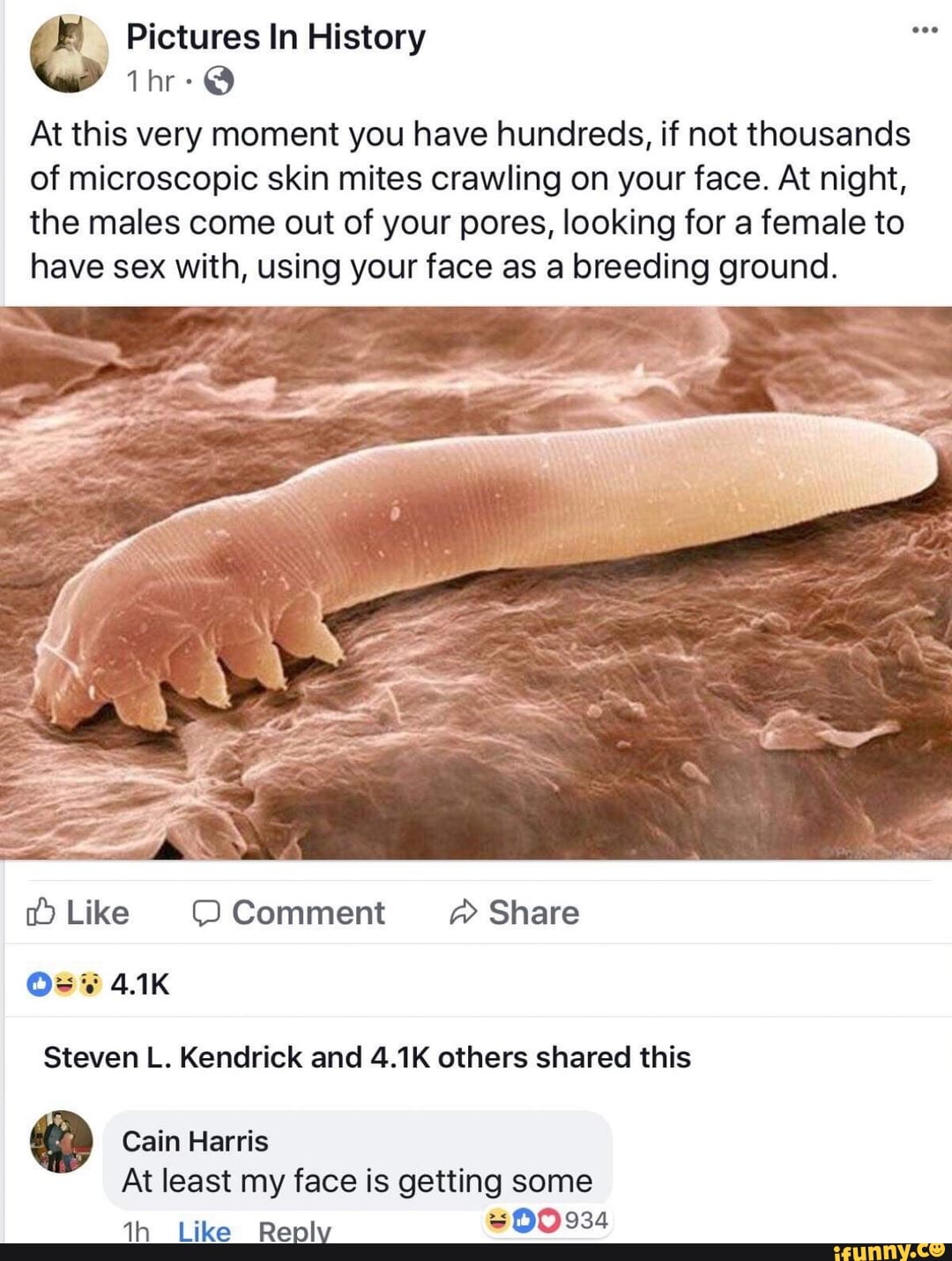 Microscopic Skin Mites Crawling On Your Face Toxoplasmosis