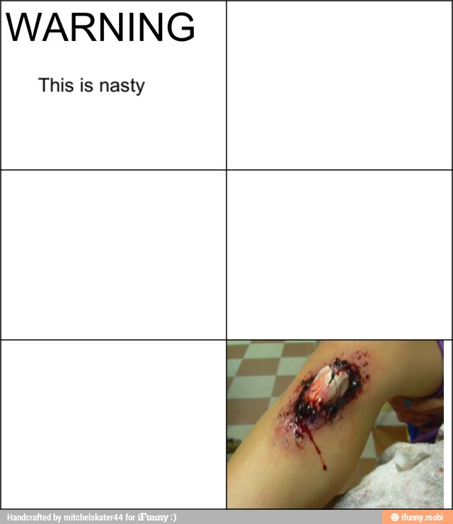 WARNING
This is nasty