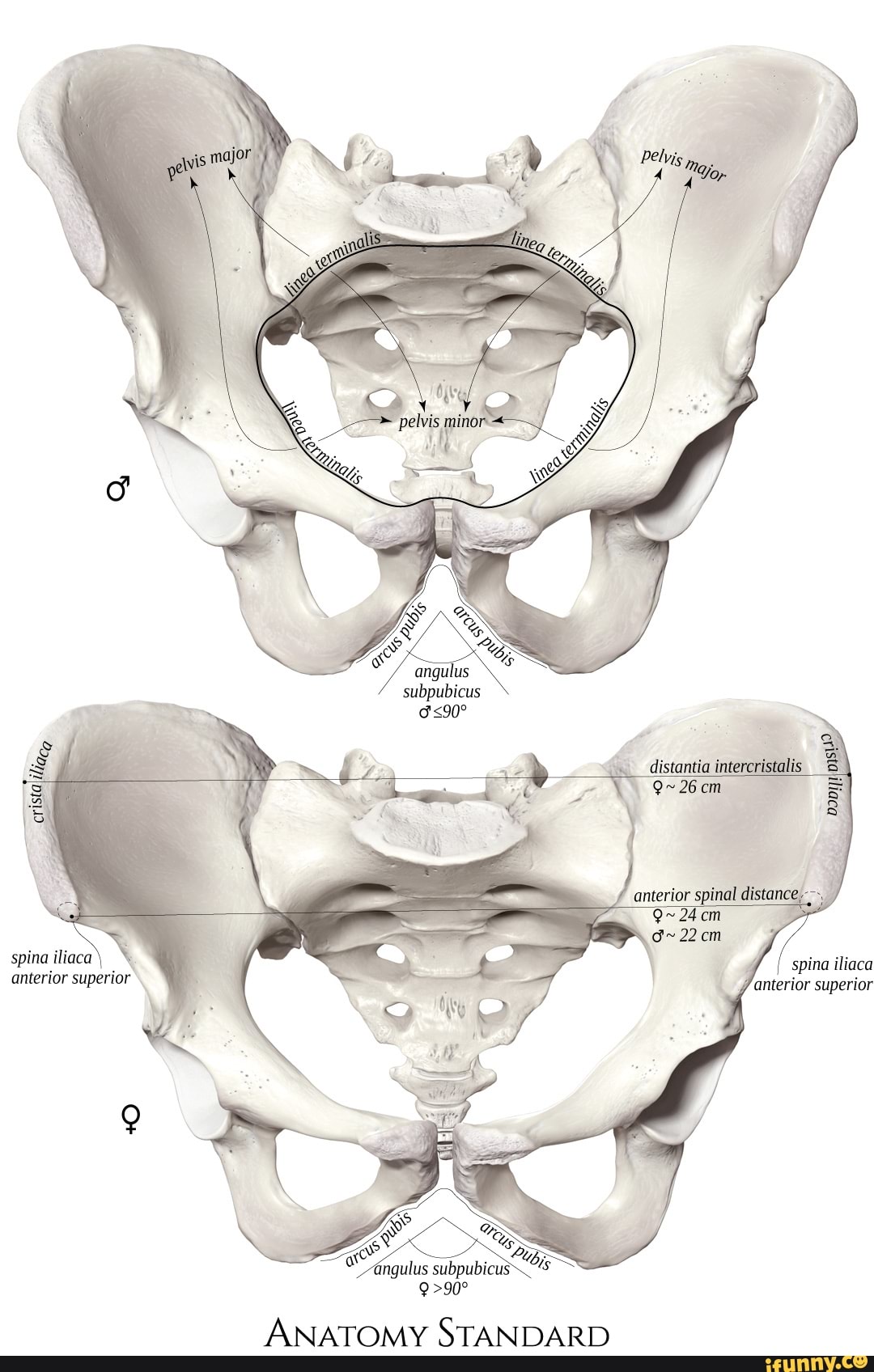 Spina anterior superior angulus subpubicus distontia intercristalis spina iliaca anterior superior STANDARD - )