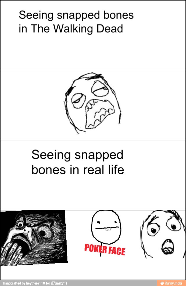 Seeing snapped bones
in The Walking Dead
Seeing snapped
bones in real life