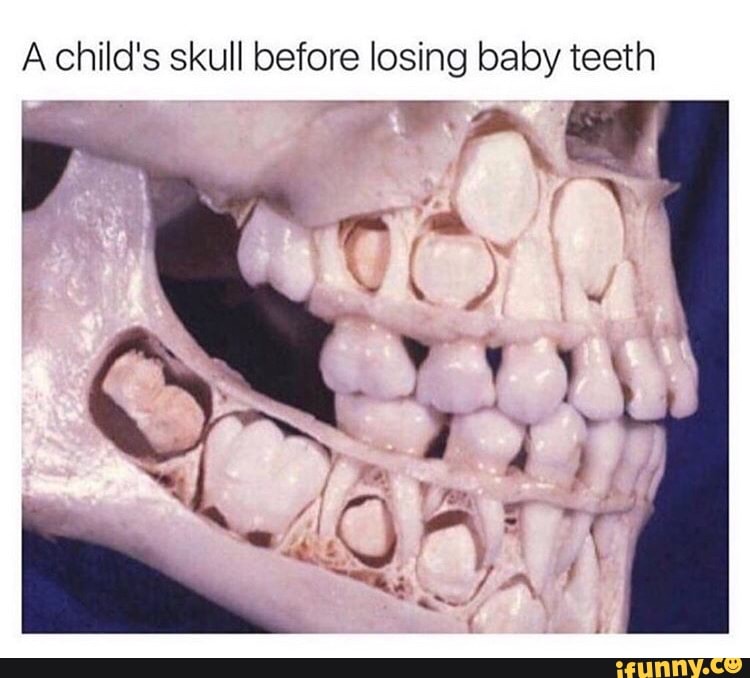 A ea s skull before losing baby teeth