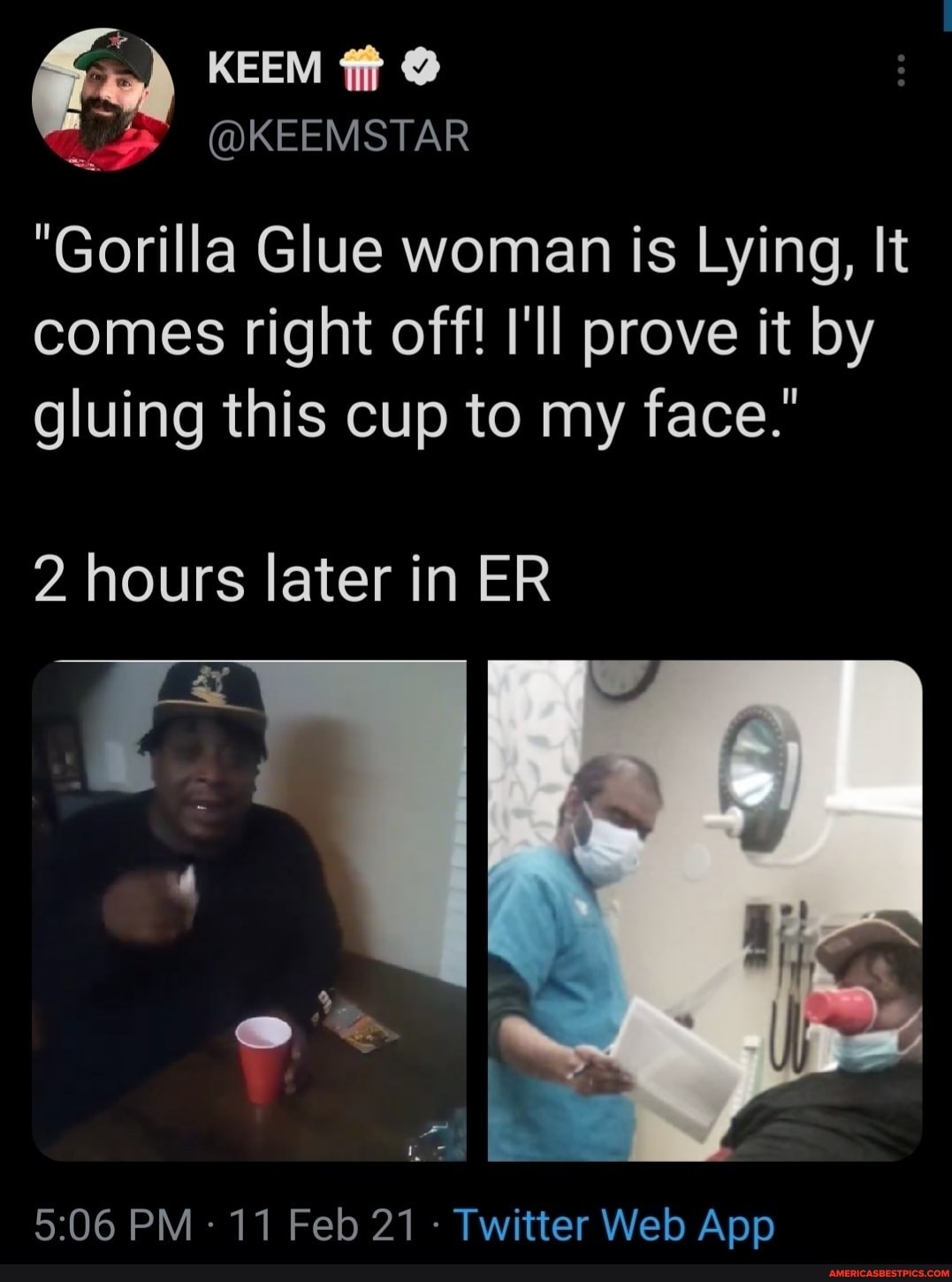 id
KEEM
@KEEMSTAR
"Gorilla Glue woman is Lying, It comes right off! I'll prove it by gluing this cup to my face."
2 hours later in ER
