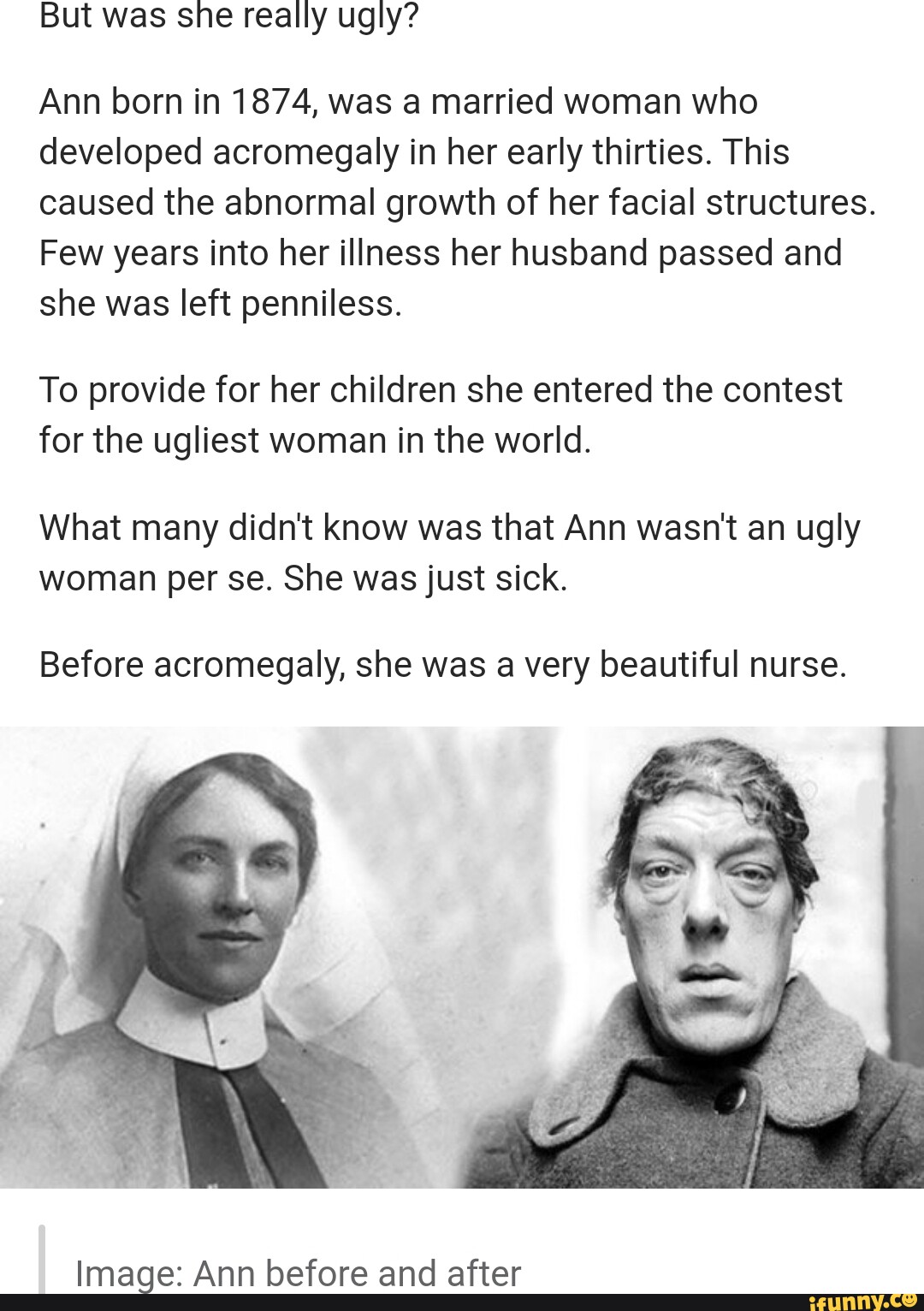 But was she really ugly? Ann born in 1874, was a married woman who ...