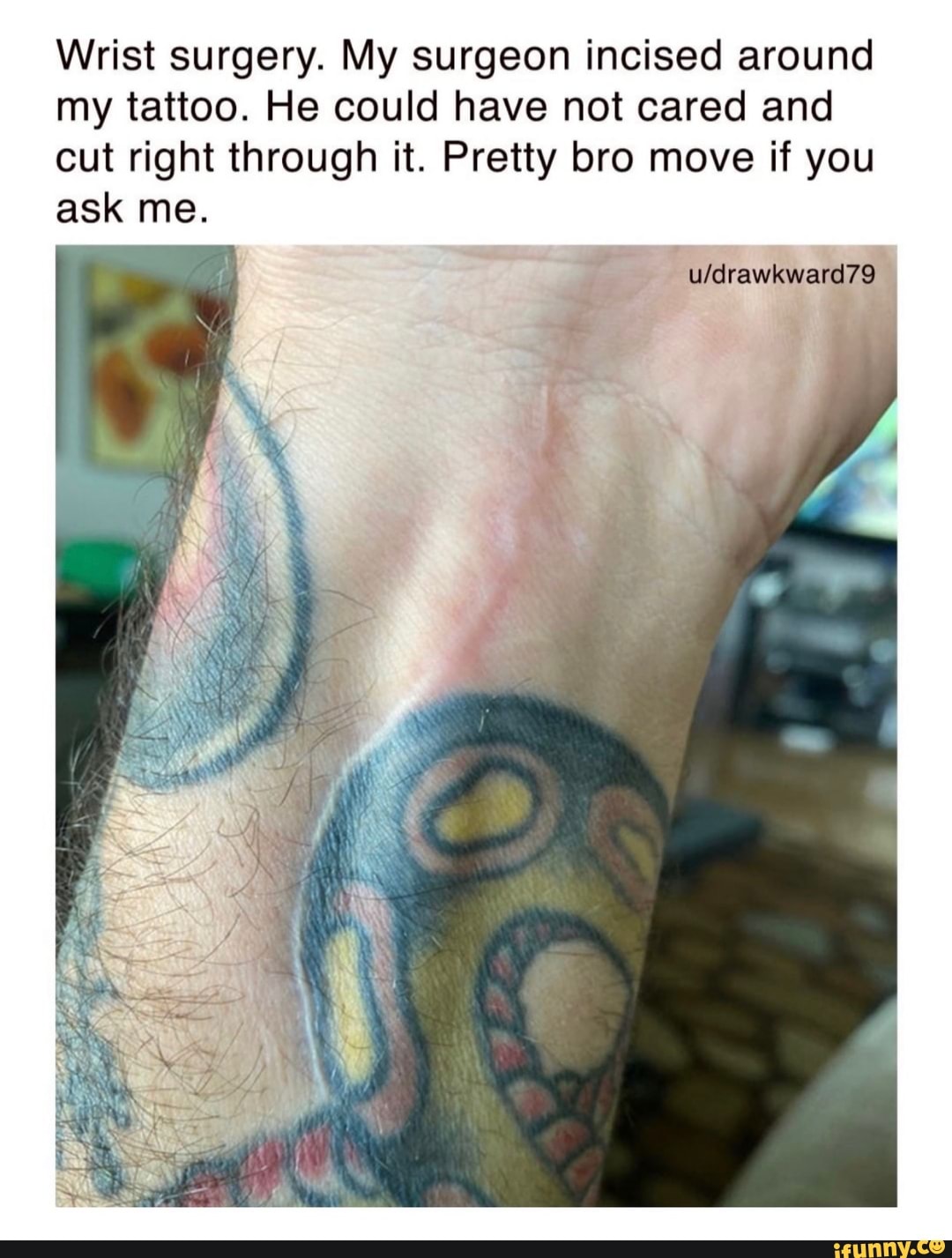 If you have tattoos and you cut your skin will your tattoo mess up  Quora